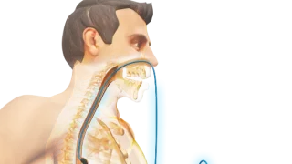 The Endovac™ endoscopic suturing device